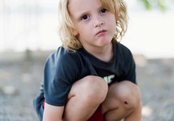 Niño con melena rubia y ojos oscuros, de cuclillas mirando directamente a la cámara.